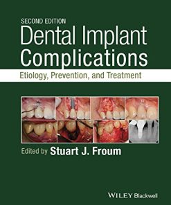 Dental Implant Complications Etiology Prevention and Treatment 8211 2nd
