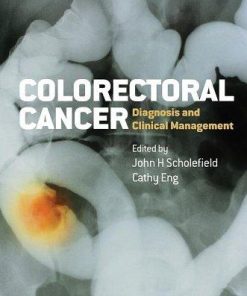 Colorectal Cancer Diagnosis And Clinical Management