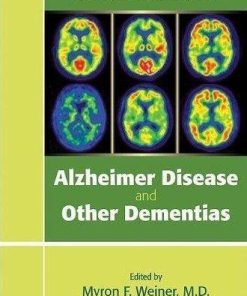 Clinical Manual Of Alzheimer Disease And Other Dementias